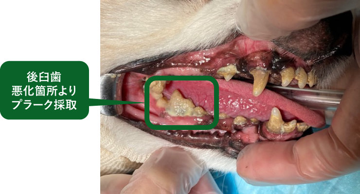 後臼歯悪化箇所よりプラーク採取